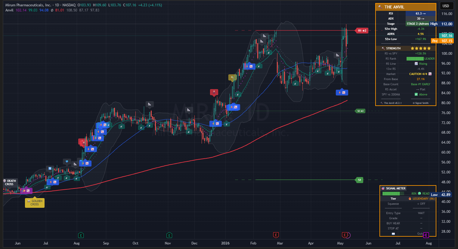MIRM TradingView chart with The Anvil signals and dashboard panels